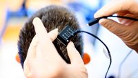 A photo of researchers connecting a person's brain implant to a voice synthesizer computer. 